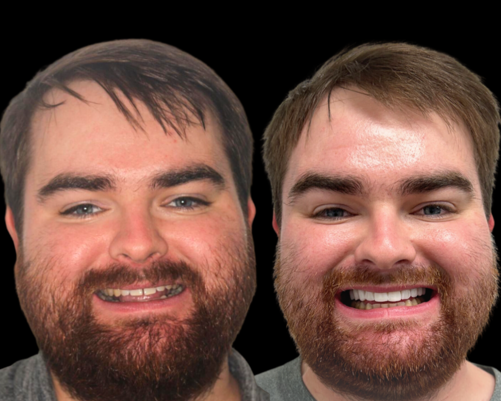 Refined edges and symmetry