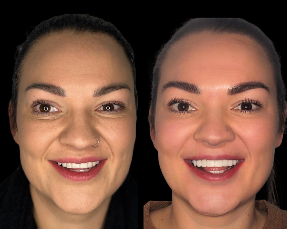 Precision-guided placement